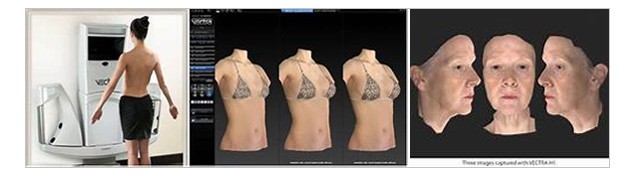 Vectra 3D Photography for plastic surgery