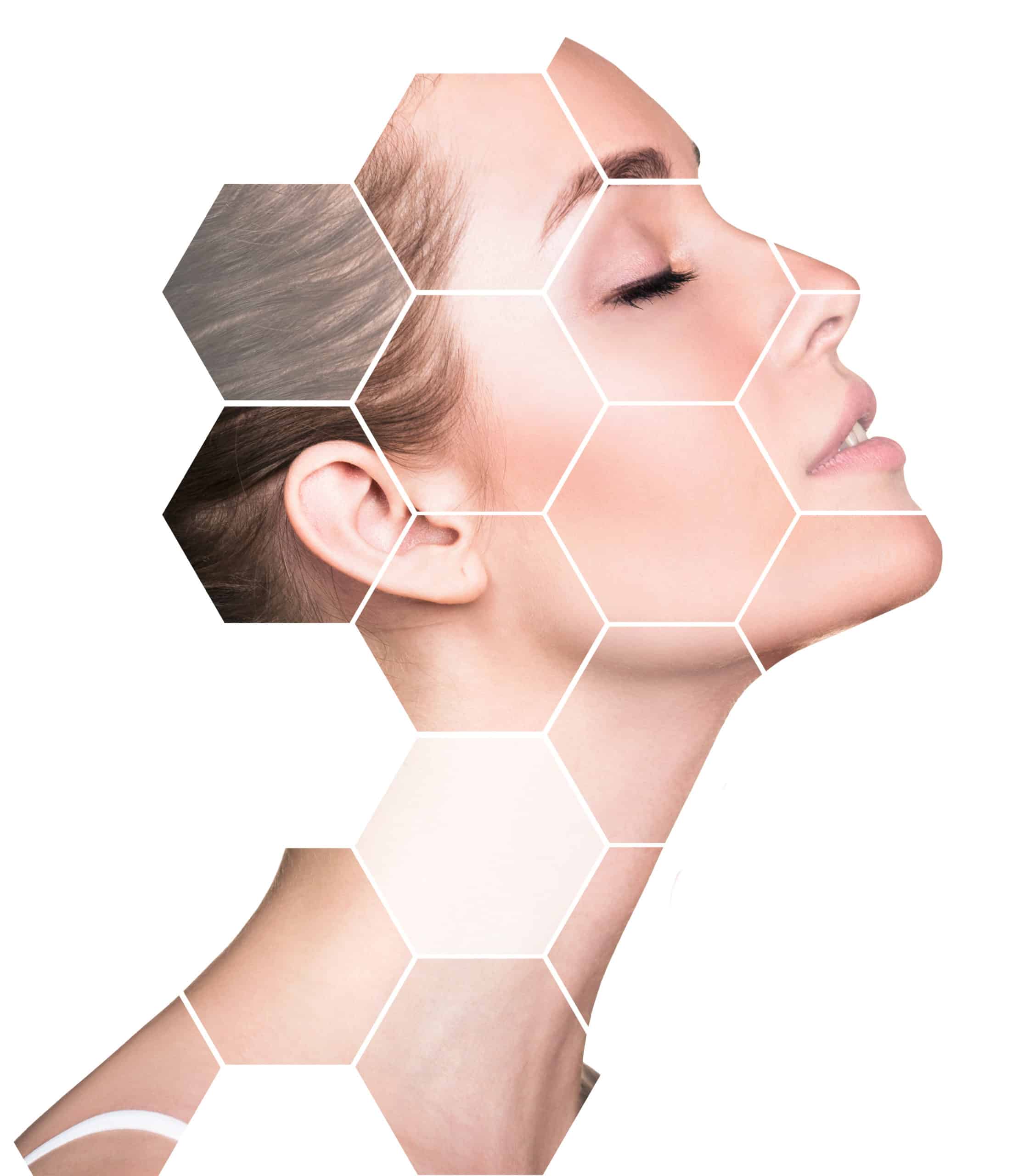 Skin rejuvenation Montreal