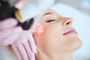 Laser Skin Resurfacing Treatments Montreal