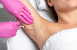 Botox for Hyperhidrosis Pointe Claire