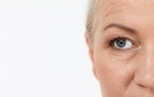 Botox versus a brow lift in Montreal