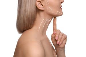 Attractive woman points to her chin and lower face, showing how her side profile improved after a short-scar facelift
